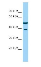 CORO1C antibody Western Blot of Fetal Brain.