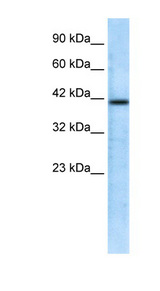 CHRFAM7A antibody LS-B935 Western blot of Jurkat lysate.