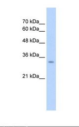 HepG2 cell lysate. Antibody concentration: 2.5 ug/ml. Gel concentration: 12%.