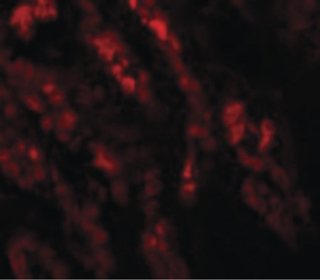 Immunofluorescence of GLS2 in Human Kidney cells with GLS2 antibody at 20 ug/ml.
