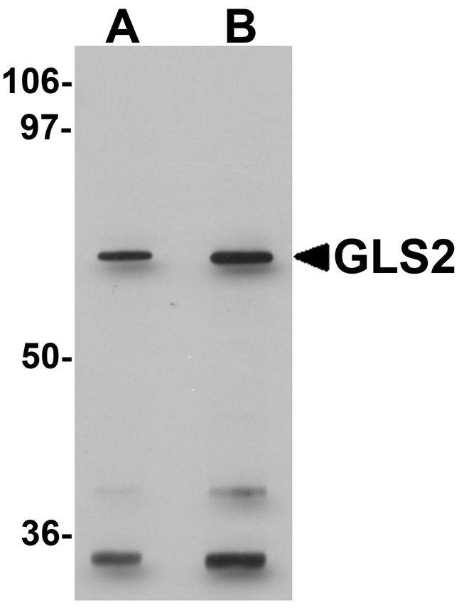 Western blot analysis of GLS2 in rat kidney tissue lysate with GLS2 antibody at (A) 0.5 and (B) 1 ug/ml.