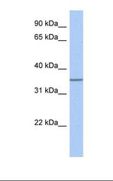 Fetal heart lysate. Antibody concentration: 1.0 ug/ml. Gel concentration: 12%.
