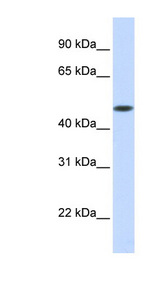 GLT8D1 antibody LS-C102121 Western blot of Fetal Muscle lysate.