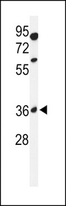 Western blot of GL8D2 Antibody in 293 cell line lysates (35 ug/lane). GL8D2 (arrow) was detected using the purified antibody.