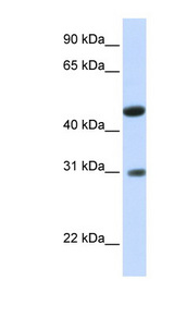 GLTPD2 antibody LS-C102130 Western blot of Fetal Muscle lysate.
