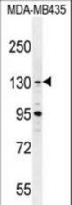 GLTSCR1 Antibody western blot of MDA-MB435 cell line lysates (35 ug/lane). The GLTSCR1 antibody detected the GLTSCR1 protein (arrow).