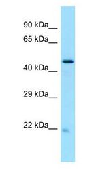 GLTSCR2 antibody Western Blot of 293T cell lysate. GLTSCR2 is supported by BioGPS gene expression data to be expressed in HEK293T.