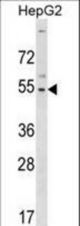 GLTSCR2 Antibody western blot of HepG2 cell line lysates (35 ug/lane). The GLTSCR2 antibody detected the GLTSCR2 protein (arrow).