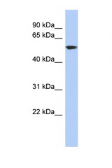 GLUD1 antibody LS-C111057 Western blot of HT1080 Cell lysate. Antibody concentration 1 ug/ml.