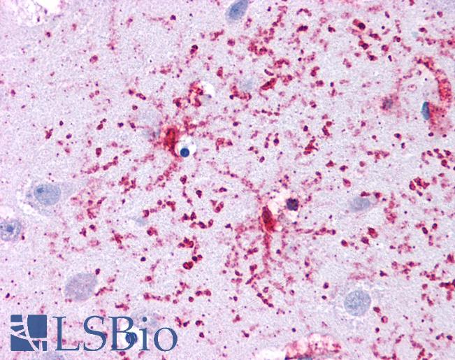 Anti-GLUD1 antibody IHC of human brain, cortex. Immunohistochemistry of formalin-fixed, paraffin-embedded tissue after heat-induced antigen retrieval. Antibody LS-B4661 concentration 5 ug/ml.