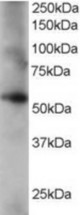 Antibody staining (0.2 ug/ml) of human lung lysate (RIPA buffer, 35 ug total protein per lane). Primary incubated for 1 hour. Detected by Western blot of chemiluminescence.
