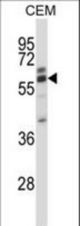 CORO2A Antibody western blot of CEM cell line lysates (35 ug/lane). The CORO2A antibody detected the CORO2A protein (arrow).