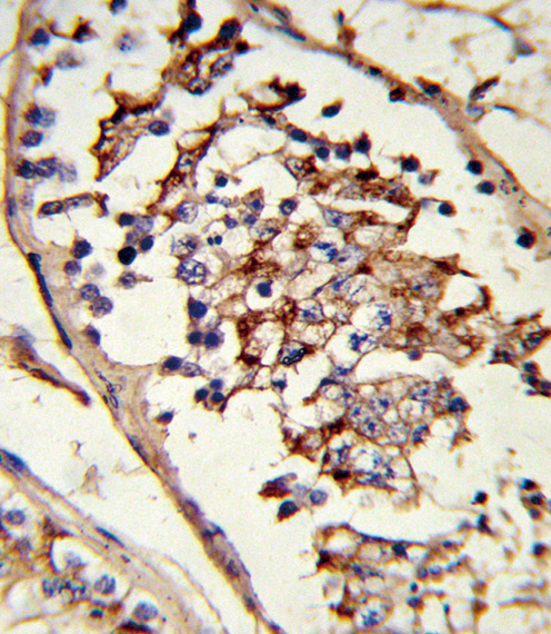 Formalin-fixed and paraffin-embedded human testis tissue reacted with GLUL Antibody , which was peroxidase-conjugated to the secondary antibody, followed by DAB staining. This data demonstrates the use of this antibody for immunohistochemistry; clinical relevance has not been evaluated.