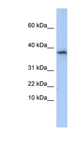 GLYAT antibody LS-C102314 Western blot of HepG2 cell lysate.