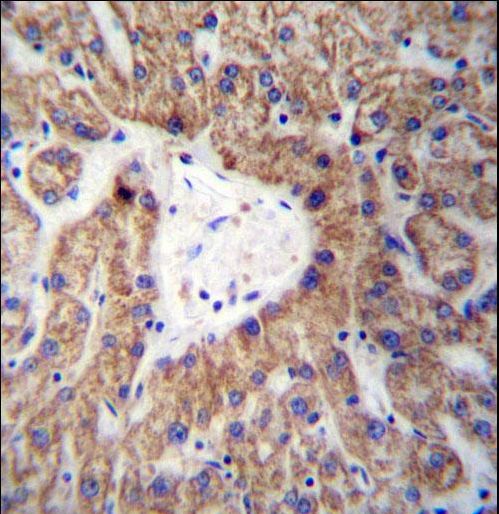 GLYAT Antibody immunohistochemistry of formalin-fixed and paraffin-embedded human liver tissue followed by peroxidase-conjugated secondary antibody and DAB staining.