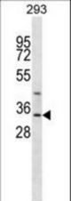 GLYAT Antibody western blot of 293 cell line lysates (35 ug/lane). The GLYAT antibody detected the GLYAT protein (arrow).