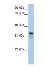 721_B cell lysate. Antibody concentration: 1.0 ug/ml. Gel concentration: 12%.