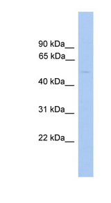 GLYCTK antibody LS-C117120 Western blot of PANC1 cell lysate.