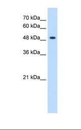 HepG2 cell lysate. Antibody concentration: 1.25 ug/ml. Gel concentration: 12%.