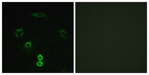 Immunofluorescence of A549 cells, using GLCTK Antibody. The picture on the right is treated with the synthesized peptide.