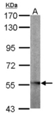 Sample (50 ug of whole cell lysate). A: mouse liver. 7.5% SDS PAGE. GLYCTK / Glycerate Kinase antibody diluted at 1:1000.
