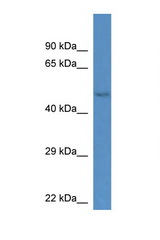 GM13178 antibody LS-C135164 Western blot of Mouse Kidney lysate. Antibody concentration 1 ug/ml.