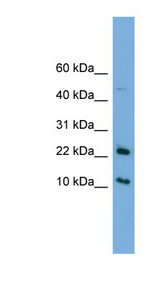 GM2A antibody LS-C116318 Western blot of HeLa lysate.