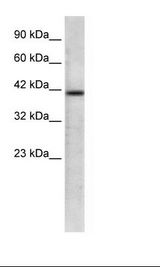 Jurkat Cell Lysate