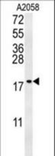 GM2A Antibody western blot of A2058 cell line lysates (35 ug/lane). The GM2A antibody detected the GM2A protein (arrow).