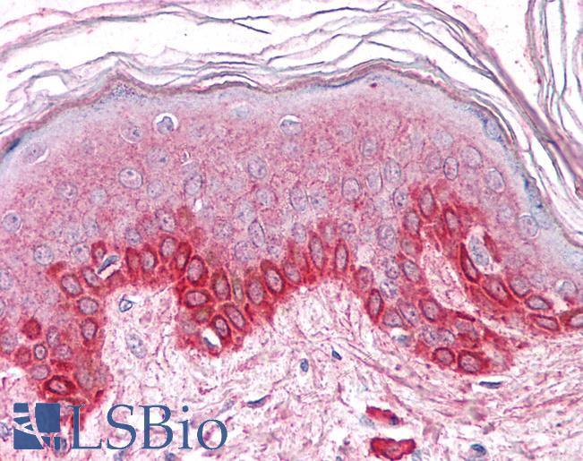 Anti-GM2A antibody LS-A8933 IHC of human skin. Immunohistochemistry of formalin-fixed, paraffin-embedded tissue after heat-induced antigen retrieval.