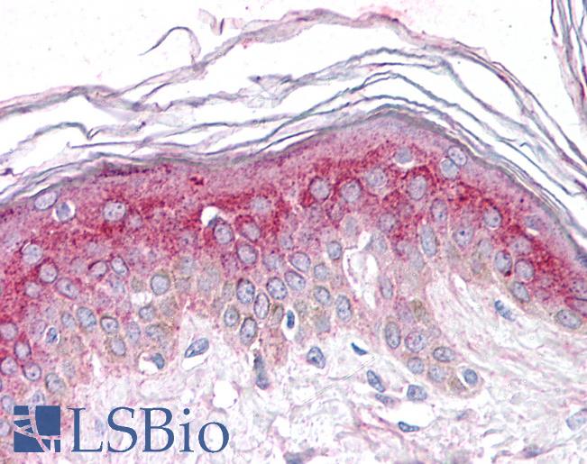 Anti-GM2A antibody LS-A8932 IHC of human skin. Immunohistochemistry of formalin-fixed, paraffin-embedded tissue after heat-induced antigen retrieval.
