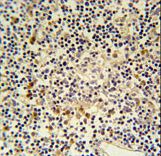 CORO6 Antibody immunohistochemistry of formalin-fixed and paraffin-embedded human lymph tissue followed by peroxidase-conjugated secondary antibody and DAB staining.