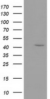 HEK293T cells were transfected with the pCMV6-ENTRY control (Left lane) or pCMV6-ENTRY GMDS (Right lane) cDNA for 48 hrs and lysed. Equivalent amounts of cell lysates (5 ug per lane) were separated by SDS-PAGE and immunoblotted with anti-GMDS.