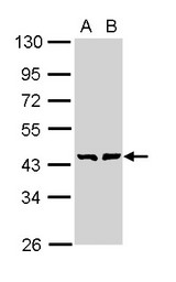 Sample (30 ug of whole cell lysate). A: A431 , B: H1299. 10% SDS PAGE. GMDS / GMD antibody diluted at 1:1000.