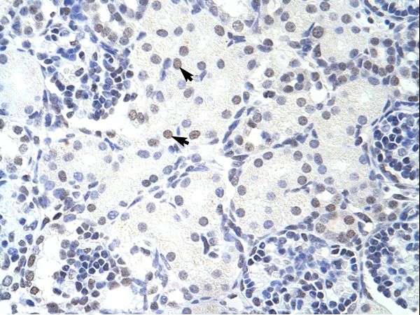 GMEB2 antibody LS-C31242 was used in IHC to stain formalin-fixed, paraffin-embedded human kidney.
