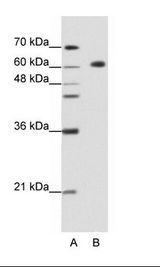 A: Marker, B: HepG2 Cell Lysate