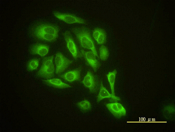 Immunofluorescence of monoclonal antibody to GMFB on HeLa cell. [antibody concentration 10 ug/ml]