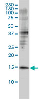 GMFB monoclonal antibody (M01), clone 2G12-2A2 Western Blot analysis of GMFB expression in Jurkat.