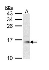Sample (30 ug of whole cell lysate). A: Raji. 15% SDS PAGE. GMF Beta / GMFB antibody diluted at 1:1000.