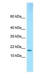 GMF Beta / GMFB antibody Western Blot of Fetal Brain.