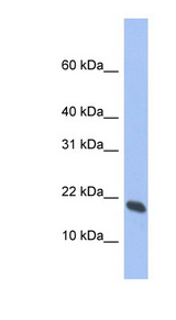 GMFG antibody LS-C112254 Western blot of Fetal Thymus lysate.
