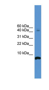 CORT / Cortistatin antibody LS-C135545 Western blot of 721_B cell lysate.
