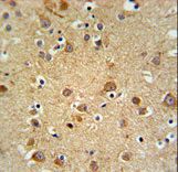 GMFG Antibody IHC of formalin-fixed and paraffin-embedded brain tissue followed by peroxidase-conjugated secondary antibody and DAB staining.