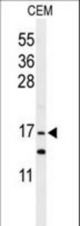 Western blot of GMFG Antibody in CEM cell line lysates (35 ug/lane). GMFG (arrow) was detected using the purified antibody.