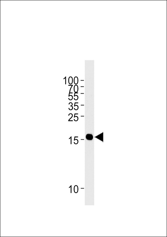 GMFG Antibody western blot of Jurkat cell line lysates (35 ug/lane). The GMFG antibody detected the GMFG protein (arrow).