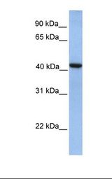 Fetal lung lysate. Antibody concentration: 1.0 ug/ml. Gel concentration: 12%.