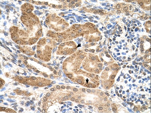 GMPPB antibody LS-C81311 was used in IHC to stain formalin-fixed, paraffin-embedded human kidney.