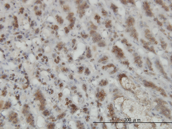 Immunoperoxidase of monoclonal antibody to GMPPB on formalin-fixed paraffin-embedded human adrenal gland. [antibody concentration 3 ug/ml]