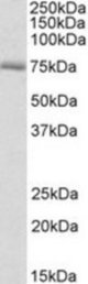 CROT antibody (0.3 ug/ml) staining of Rat Kidney lysate (35 ug protein/ml in RIPA buffer). Primary incubation was 1 hour. Detected by chemiluminescence.