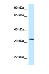 GMPR / GMPR1 antibody LS-C145839 Western blot of Jurkat Cell lysate. Antibody concentration 1 ug/ml.